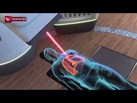 Cyberknife a Roma: La Tecnologia Innovativa per il Trattamento del Cancro