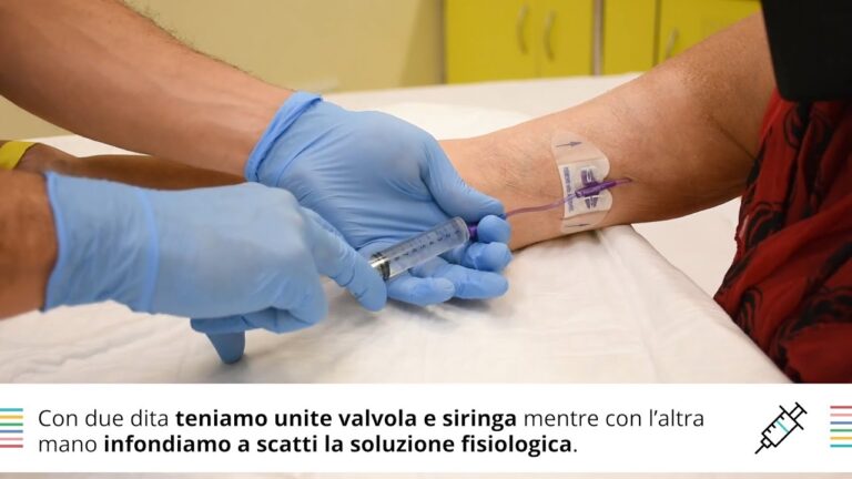 Guida ai cerotti premedicati: tutto ciò che devi sapere